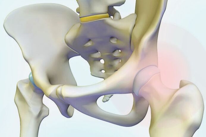 pain in the hip joint