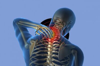 Cervical pain with osteochondrosis