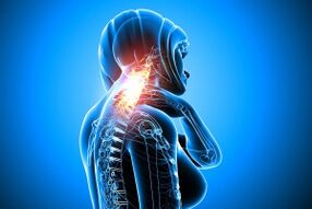 osteochondrosis in the cervical spine